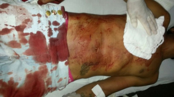 Homem � esfaqueado no peito no centro de Tabapor�