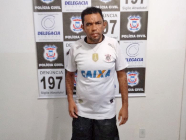 Pol�cia Civil prende acusado de atear fogo na mulher e abandon�-la na porta de hospital