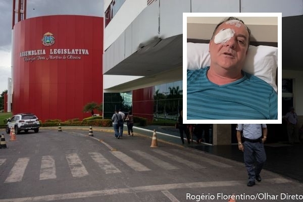 Deputado cita falta de coleira em animal, mas diz que ataque de cachorro foi uma fatalidade.