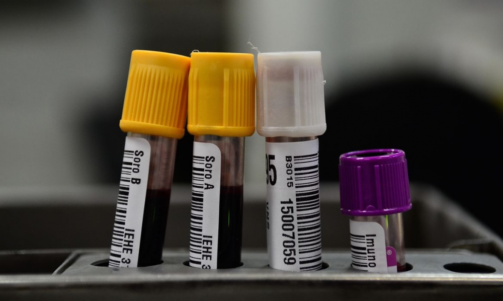 Hemorio inicia testes com plasma sangu�neo no tratamento de covid-19