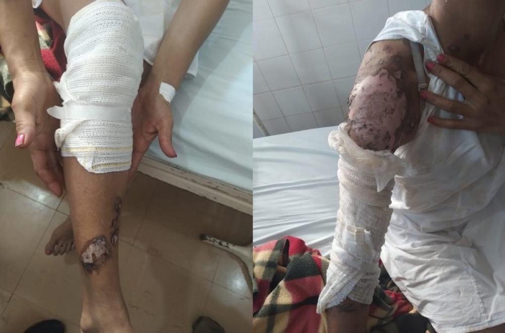 Mulher flagra trai��o e � jogada em fogueira de festa junina pela amante do marido
