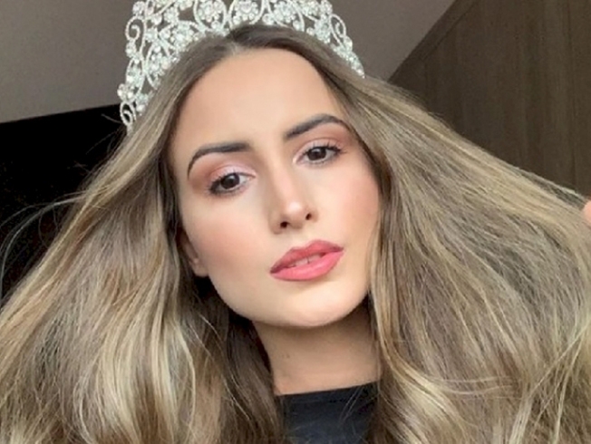 Ap�s cair de escada, bater a cabe�a e sofrer traumatismo craniano ex-miss Sorriso deixa o hospital