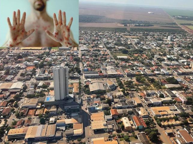 Campo Novo registra mais dois casos positivos para Var�ola dos Macacos, segundo SES