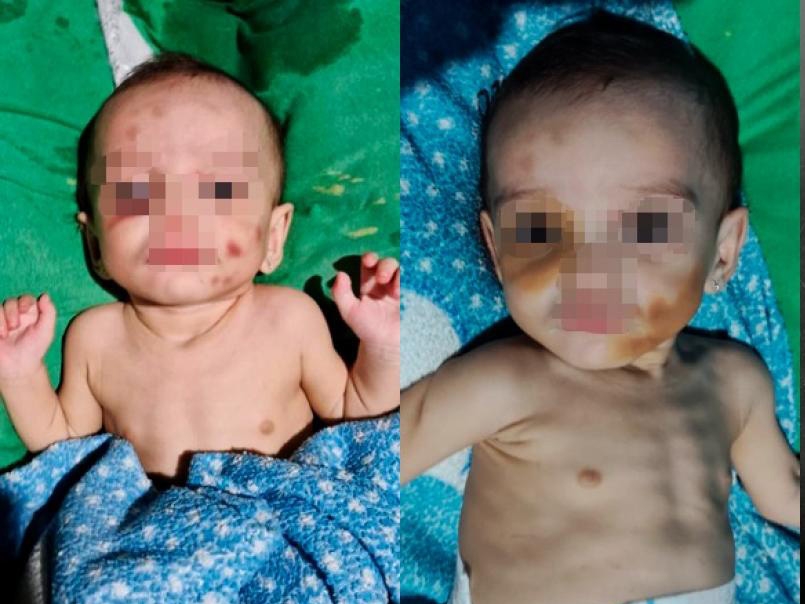 Juiz manda soltar m�e que agrediu beb� de 1 ano, mesmo a suspeita confessando as agress�es