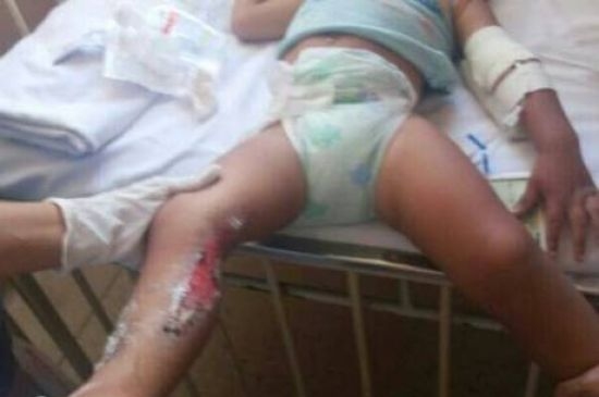 M�e abandona filho em posto ap�s tatuar crian�a e tentar remover desenho com produto qu�mico 
