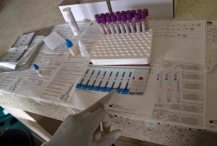 Vacina contra s�ndrome respirat�ria tem resultados promissores em animais