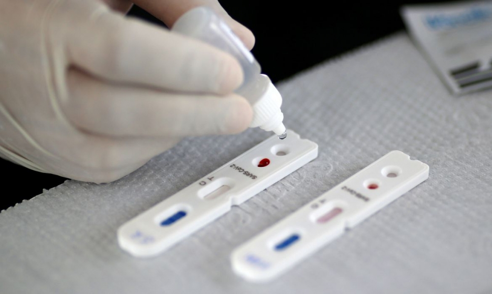 Britnicos que produzem vacina faro testes com 10 mil pessoas