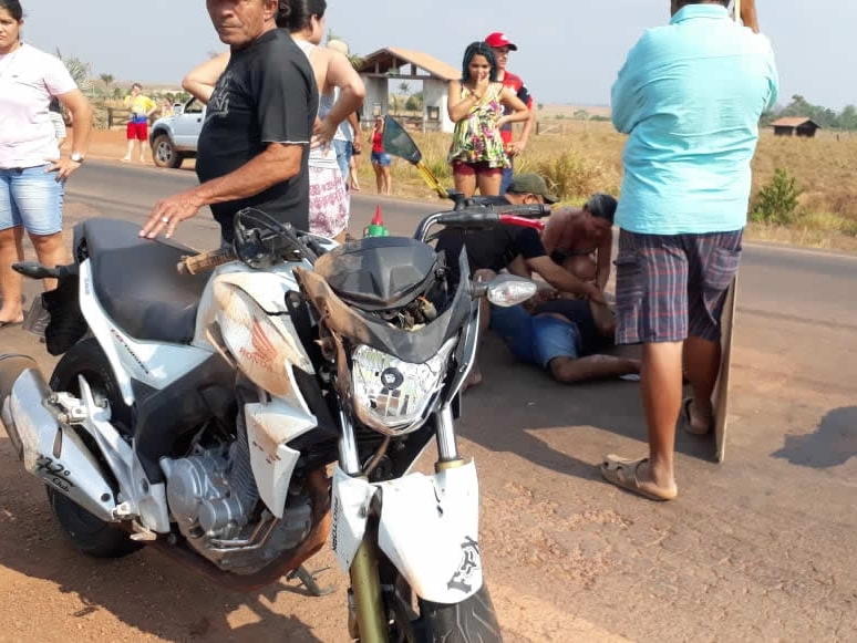 Batida frontal entre duas motos deixa um dos condutores com afundamento de cr�nio e afundamento da face.